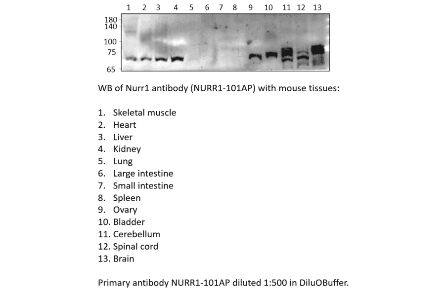 Anti-Nurr1 Antibody from FabGennix (NURR1-101AP) - Antibodies.com