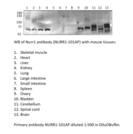 Anti-Nurr1 Antibody from FabGennix (NURR1-101AP) - Antibodies.com