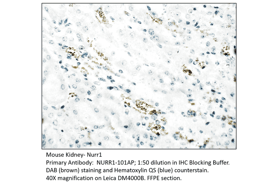 Anti-Nurr1 Antibody from FabGennix (NURR1-101AP) - Antibodies.com
