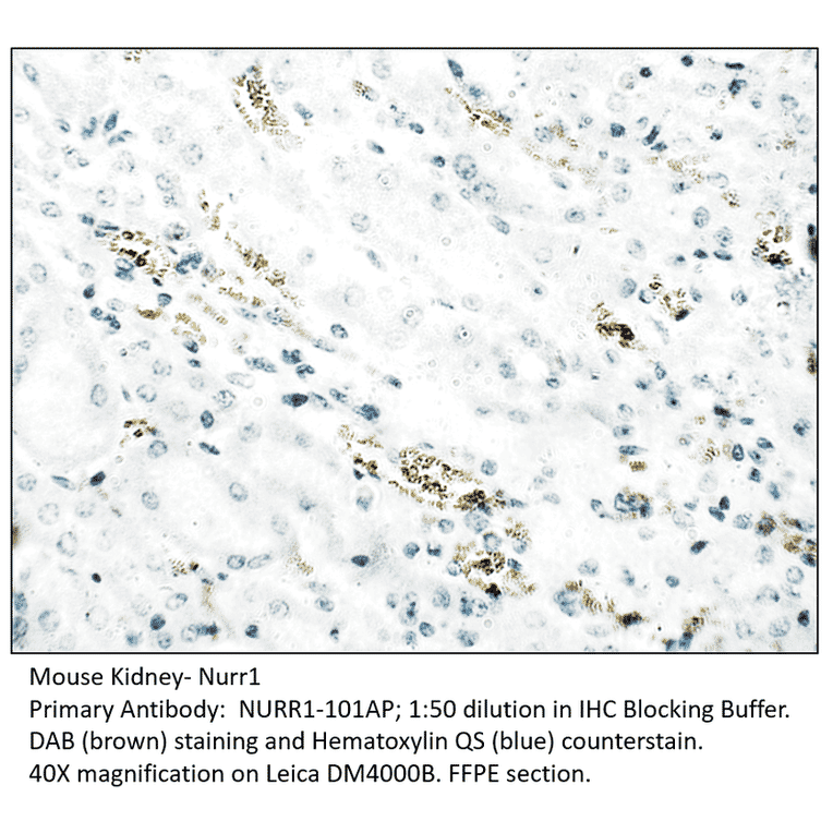 Anti-Nurr1 Antibody from FabGennix (NURR1-101AP) - Antibodies.com