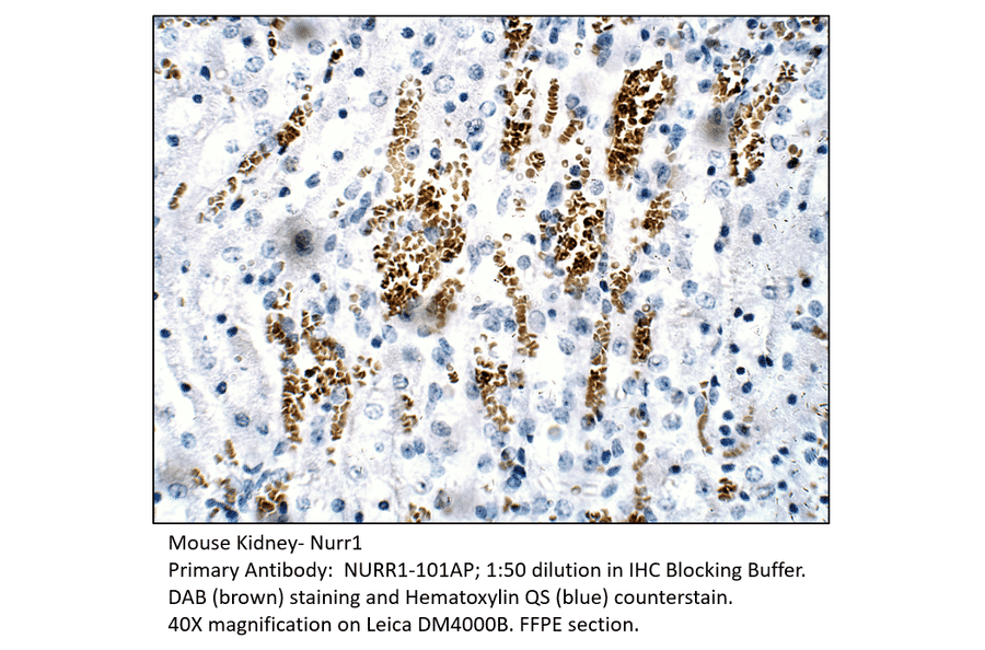 Anti-Nurr1 Antibody from FabGennix (NURR1-101AP) - Antibodies.com