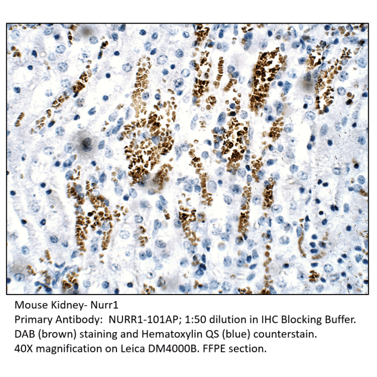 Anti-Nurr1 Antibody from FabGennix (NURR1-101AP) - Antibodies.com