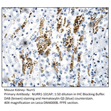 Anti-Nurr1 Antibody from FabGennix (NURR1-101AP) - Antibodies.com