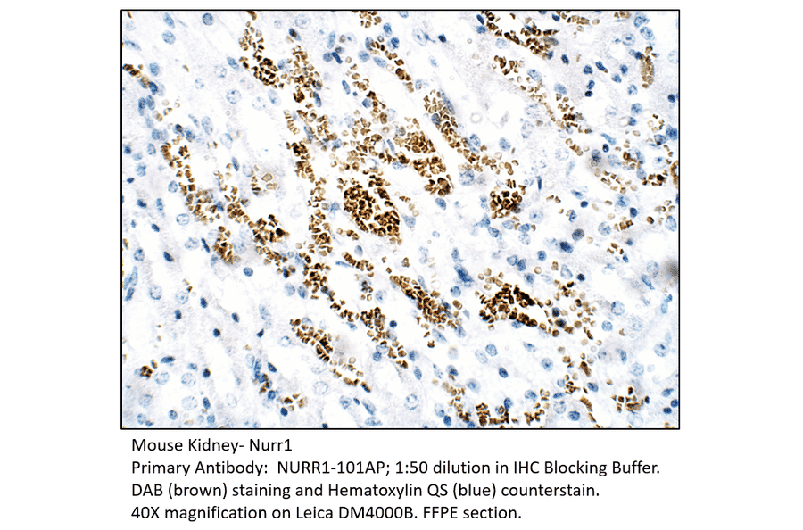 Anti-Nurr1 Antibody from FabGennix (NURR1-101AP) - Antibodies.com