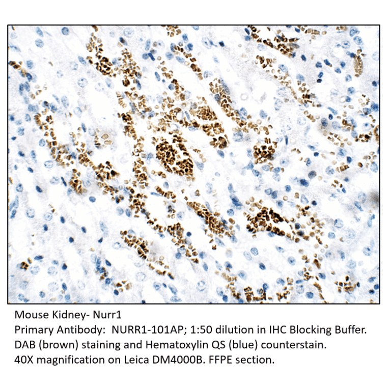 Anti-Nurr1 Antibody from FabGennix (NURR1-101AP) - Antibodies.com