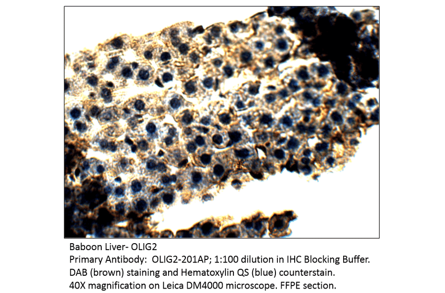 Anti-Olig2 Antibody from FabGennix (OLIG2-201AP) - Antibodies.com