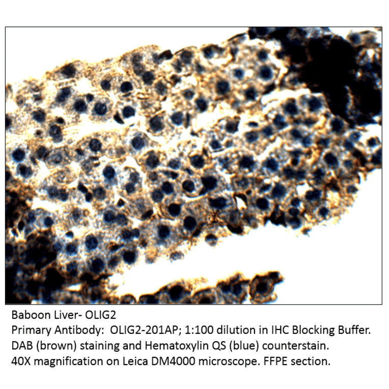 Anti-Olig2 Antibody from FabGennix (OLIG2-201AP) - Antibodies.com