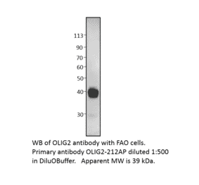 Anti-Olig2 Antibody from FabGennix (OLIG2-212AP) - Antibodies.com