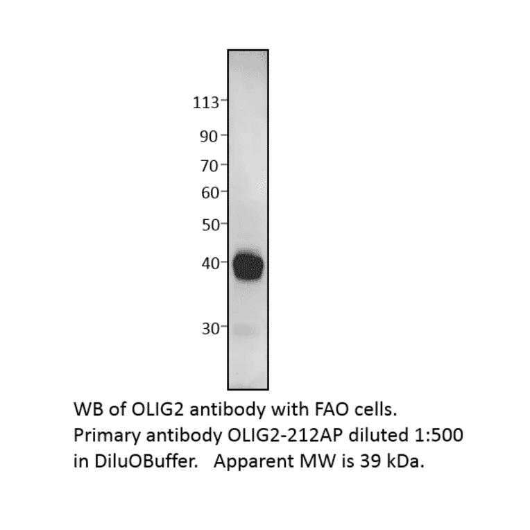 Anti-Olig2 Antibody from FabGennix (OLIG2-212AP) - Antibodies.com