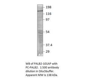 Anti-PALB2 Antibody from FabGennix (PALB2-101AP) - Antibodies.com