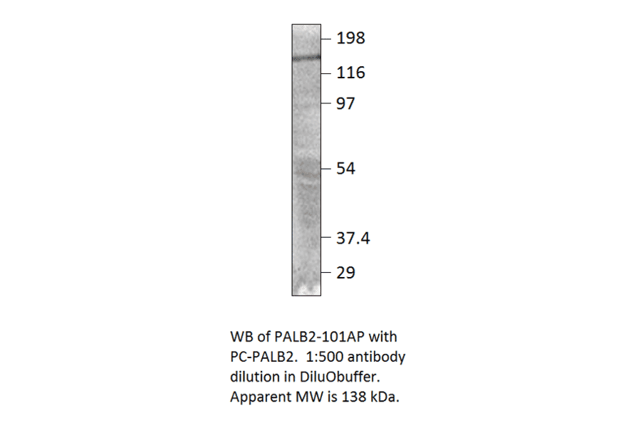 Anti-PALB2 Antibody from FabGennix (PALB2-101AP) - Antibodies.com