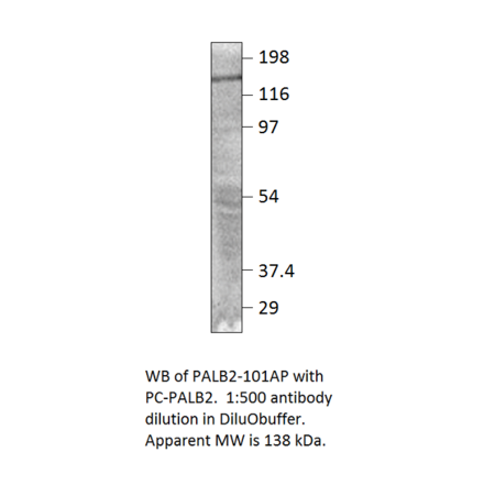 Anti-PALB2 Antibody from FabGennix (PALB2-101AP) - Antibodies.com