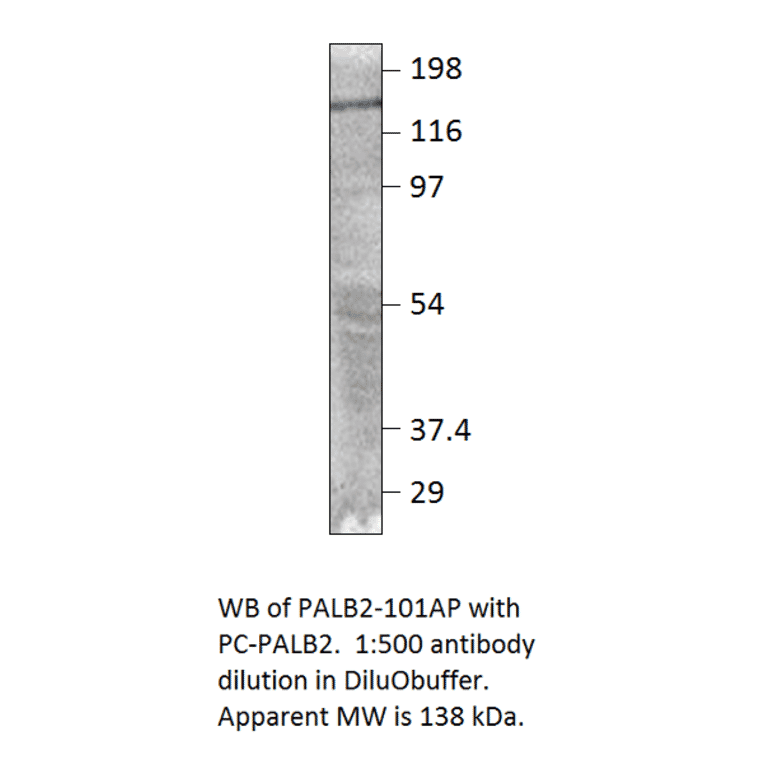 Anti-PALB2 Antibody from FabGennix (PALB2-101AP) - Antibodies.com