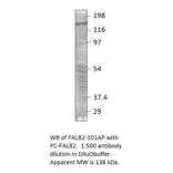 Anti-PALB2 Antibody from FabGennix (PALB2-101AP) - Antibodies.com