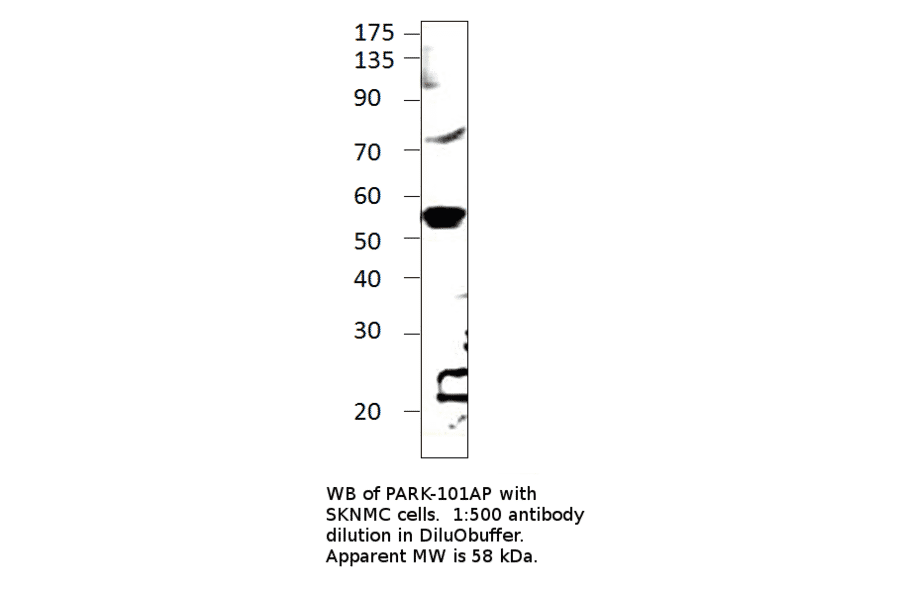 Anti-Parkin Antibody from FabGennix (PARK-101AP) - Antibodies.com
