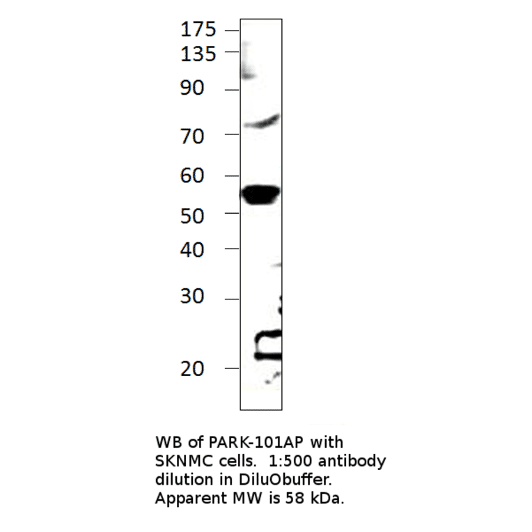 Anti-Parkin Antibody from FabGennix (PARK-101AP) - Antibodies.com