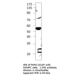 Anti-Parkin Antibody from FabGennix (PARK-101AP) - Antibodies.com