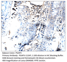 Anti-PGAP3 Antibody from FabGennix (PGAP3-112AP) - Antibodies.com