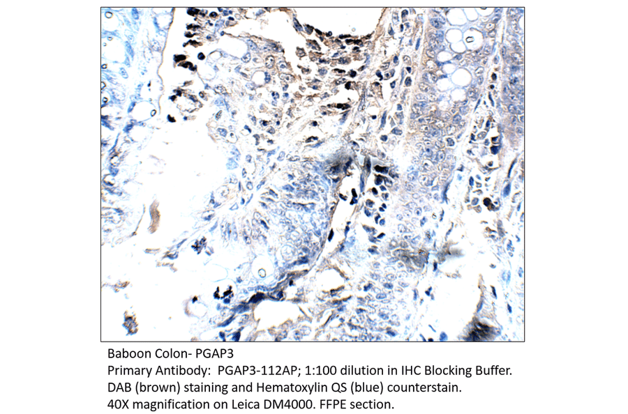 Anti-PGAP3 Antibody from FabGennix (PGAP3-112AP) - Antibodies.com