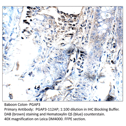 Anti-PGAP3 Antibody from FabGennix (PGAP3-112AP) - Antibodies.com