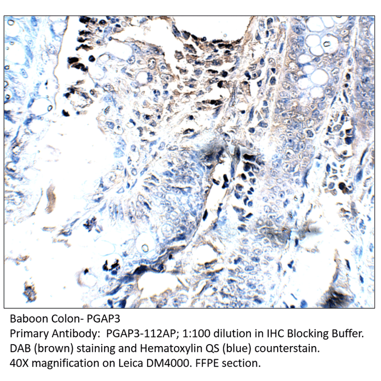 Anti-PGAP3 Antibody from FabGennix (PGAP3-112AP) - Antibodies.com