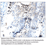 Anti-PGAP3 Antibody from FabGennix (PGAP3-112AP) - Antibodies.com