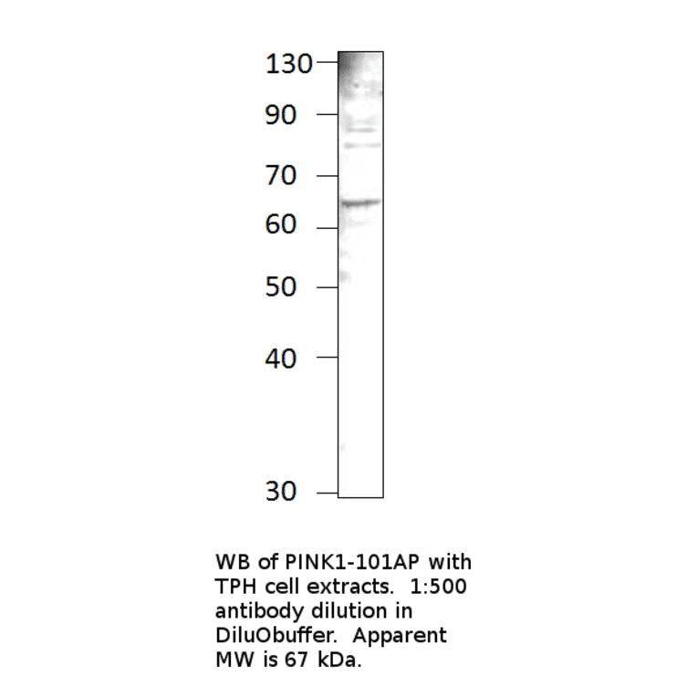 Anti-PINK1 Antibody from FabGennix (PINK1-101AP) - Antibodies.com