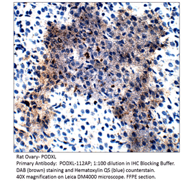 Anti-PODXL Antibody from FabGennix (PODXL-112AP) - Antibodies.com