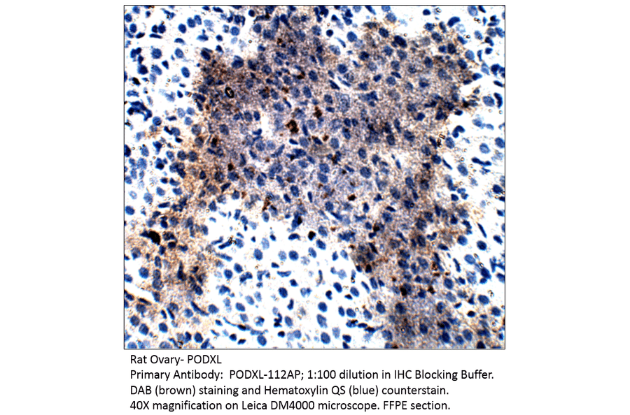 Anti-PODXL Antibody from FabGennix (PODXL-112AP) - Antibodies.com