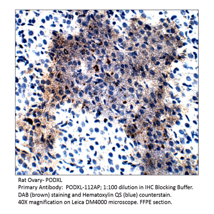 Anti-PODXL Antibody from FabGennix (PODXL-112AP) - Antibodies.com