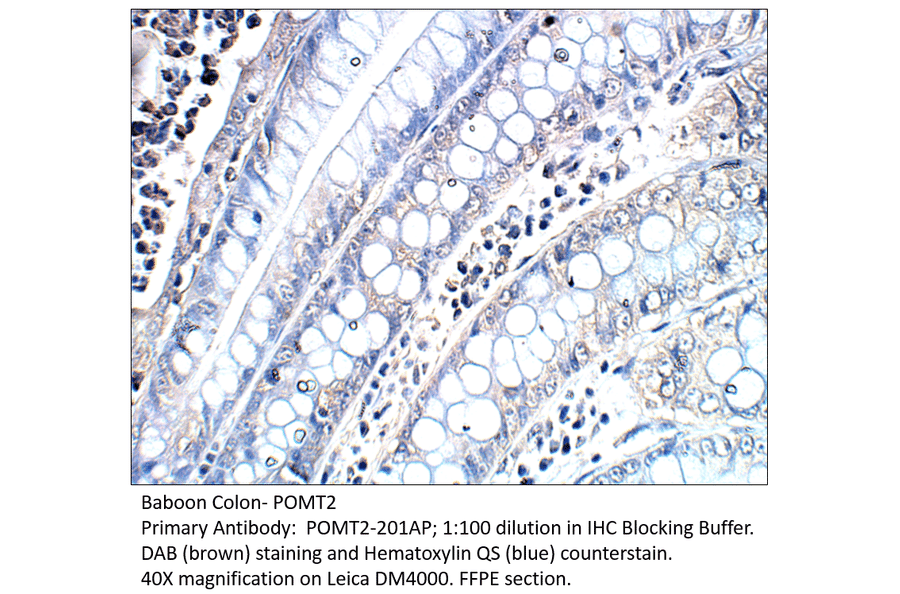 Anti-POMT2 Antibody from FabGennix (POMT2-201AP) - Antibodies.com