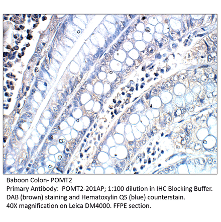 Anti-POMT2 Antibody from FabGennix (POMT2-201AP) - Antibodies.com