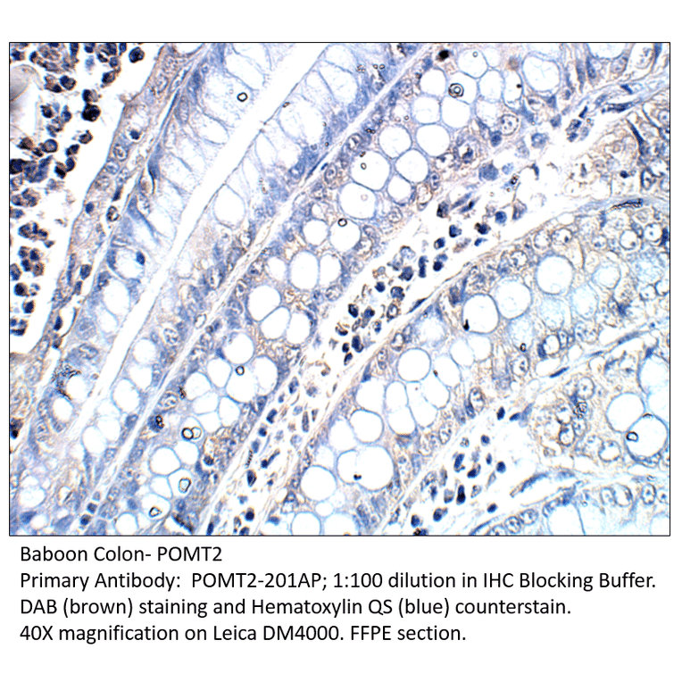 Anti-POMT2 Antibody from FabGennix (POMT2-201AP) - Antibodies.com