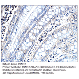 Anti-POMT2 Antibody from FabGennix (POMT2-201AP) - Antibodies.com