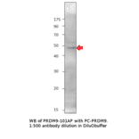 Anti-PRDM9 Antibody from FabGennix (PRDM9-901AP) - Antibodies.com