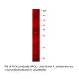 Anti-RACK1 Antibody from FabGennix (RACK1-101AP) - Antibodies.com