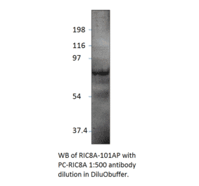 Anti-RIC8A Antibody from FabGennix (RIC8A-101AP) - Antibodies.com