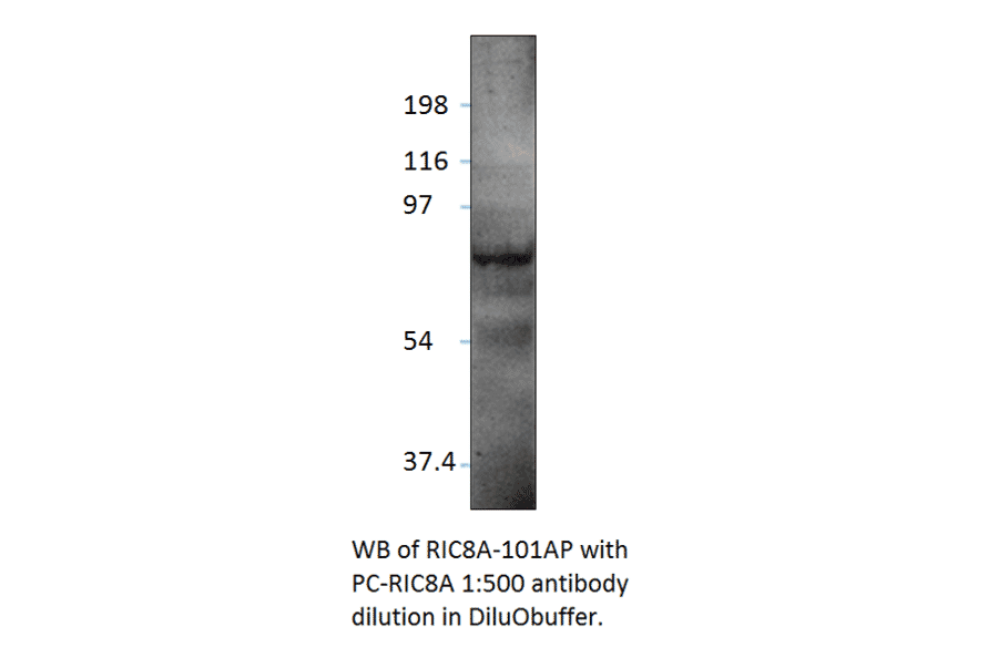 Anti-RIC8A Antibody from FabGennix (RIC8A-101AP) - Antibodies.com