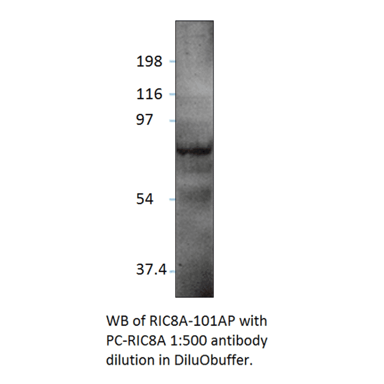 Anti-RIC8A Antibody from FabGennix (RIC8A-101AP) - Antibodies.com