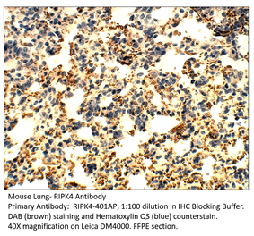 Anti-RIPK4 Antibody from FabGennix (RIPK4-401AP) - Antibodies.com