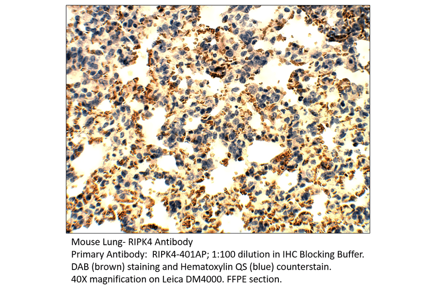 Anti-RIPK4 Antibody from FabGennix (RIPK4-401AP) - Antibodies.com
