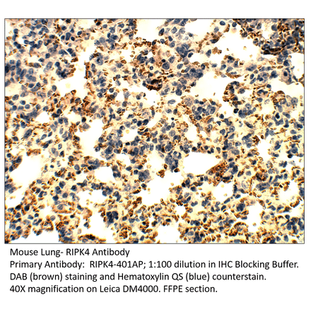 Anti-RIPK4 Antibody from FabGennix (RIPK4-401AP) - Antibodies.com