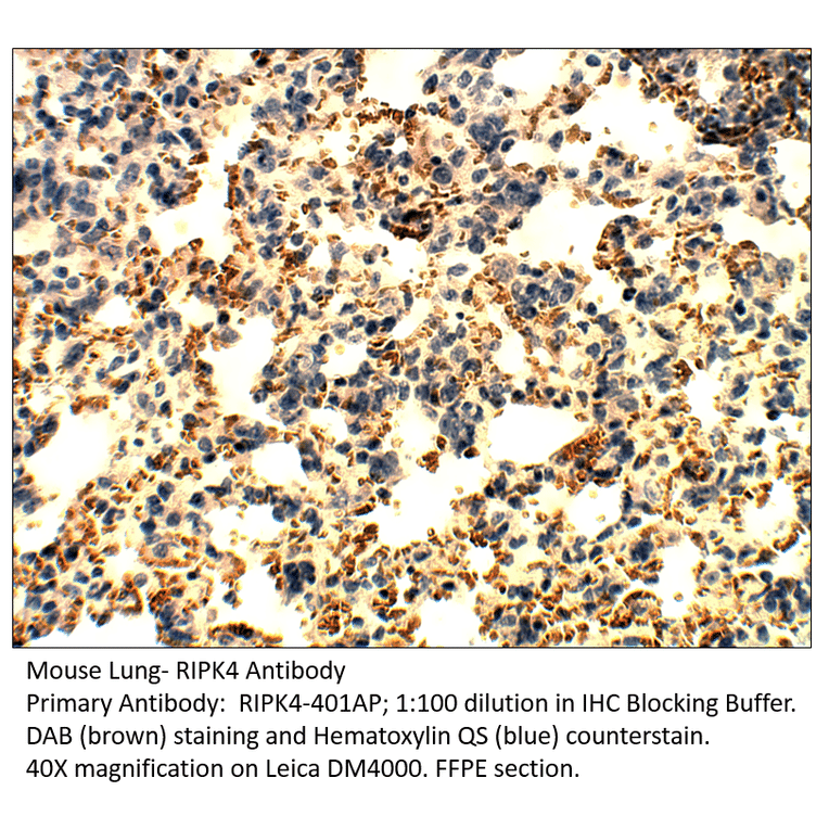 Anti-RIPK4 Antibody from FabGennix (RIPK4-401AP) - Antibodies.com