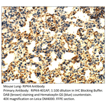 Anti-RIPK4 Antibody from FabGennix (RIPK4-401AP) - Antibodies.com
