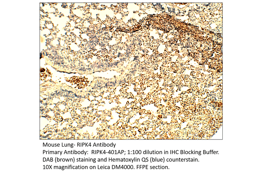 Anti-RIPK4 Antibody from FabGennix (RIPK4-401AP) - Antibodies.com