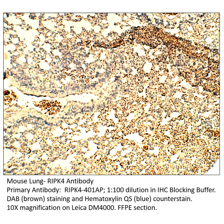 Anti-RIPK4 Antibody from FabGennix (RIPK4-401AP) - Antibodies.com