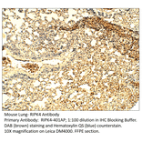 Anti-RIPK4 Antibody from FabGennix (RIPK4-401AP) - Antibodies.com