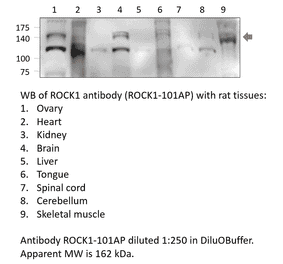Anti-ROCK1 Antibody from FabGennix (ROCK1-101AP) - Antibodies.com
