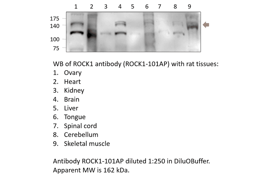 Anti-ROCK1 Antibody from FabGennix (ROCK1-101AP) - Antibodies.com