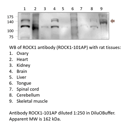 Anti-ROCK1 Antibody from FabGennix (ROCK1-101AP) - Antibodies.com